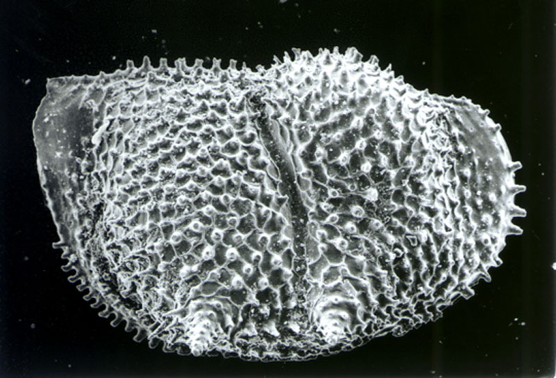 High resolution photomicrograph of an ostracod with distinctive short spines across its surface; approximate size 0.5 mm (type and source not specified)